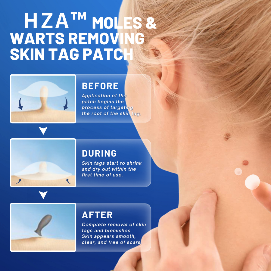 HZA™ Moles & Warts Removing Skin Tag Patch