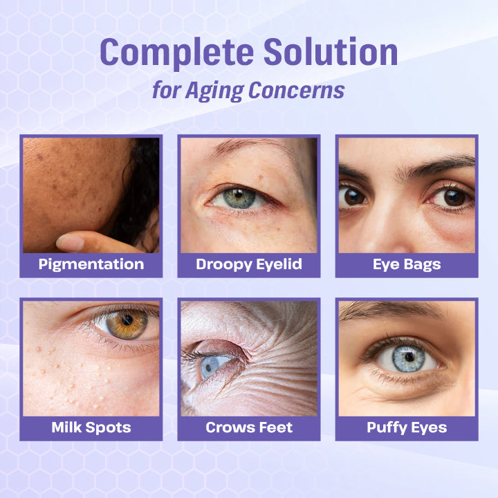 BBOJI™ Bee Poison Roller Eye Cream - 👨⚕️US Dermatologist Approved