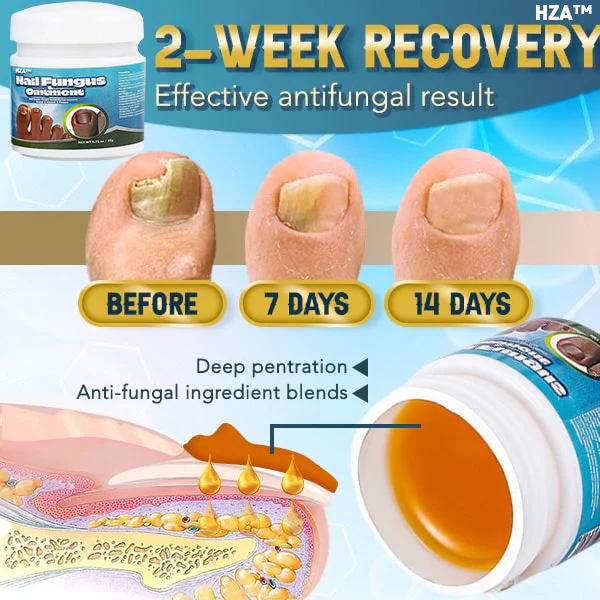 HZA™ 5X Quick-healing Nail Fungus Ointment