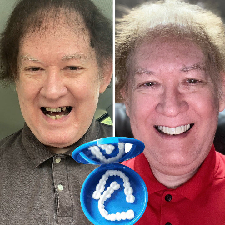 SmileFitPro™ — Custom-Fit, Affordable Denture Solution to Restore Your Natural Smile at Home