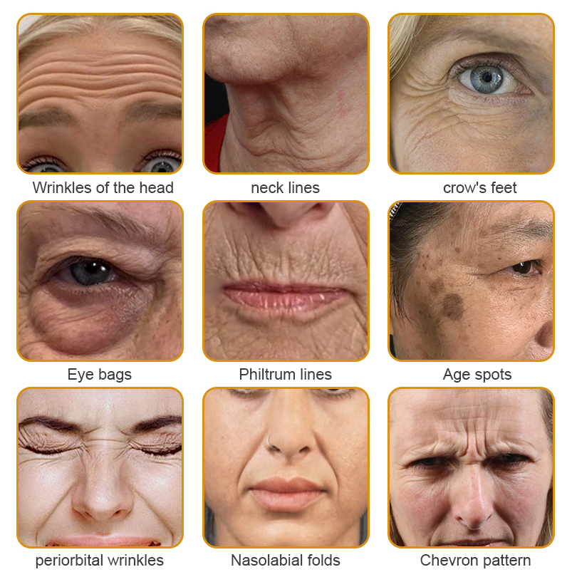 ššMade and Shipped from USAāØLOVILDS⢠Bee Toxin Wrinkle Removal Cream-š„LAST DAY 80% OFF