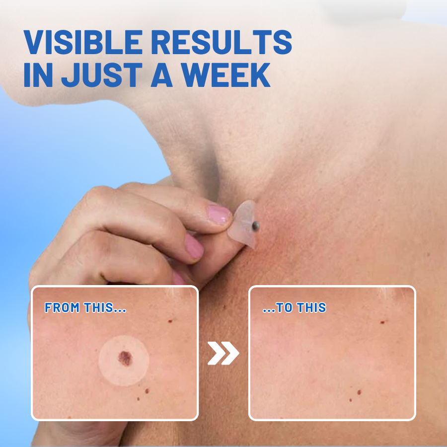 HZA™ Moles & Warts Removing Skin Tag Patch