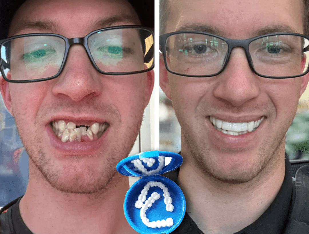 SmileFitPro™ — Custom-Fit, Affordable Denture Solution to Restore Your Natural Smile at Home