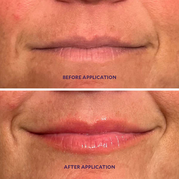 BBOJI™ Lip Plumper + Hydrator – Plumping | Volumizing | Hydrating