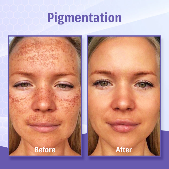 BBOJI™ Bee Poison Roller Eye Cream - 👨⚕️US Dermatologist Approved