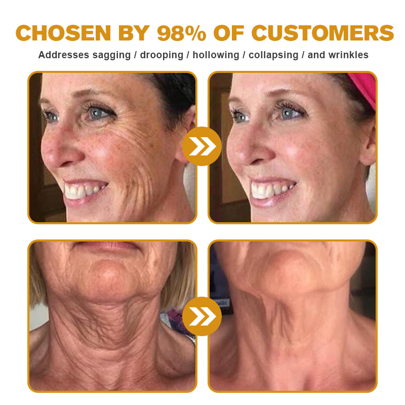 ššMade and Shipped from USAāØLOVILDS⢠Bee Toxin Wrinkle Removal Cream-š„LAST DAY 80% OFF