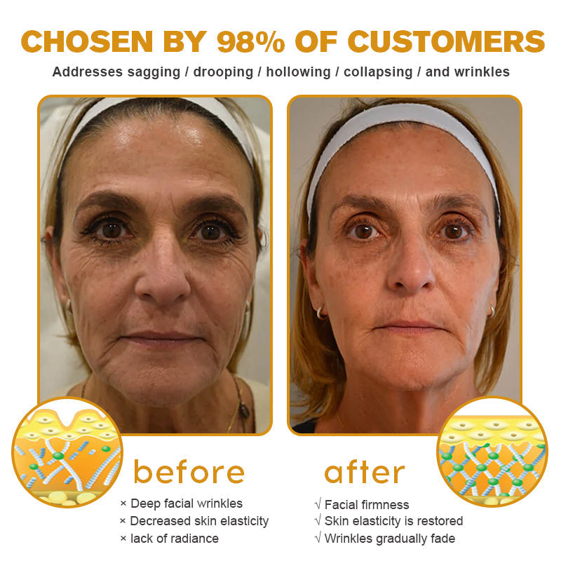 ššMade and Shipped from USAāØLOVILDS⢠Bee Toxin Wrinkle Removal Cream-š„LAST DAY 80% OFF