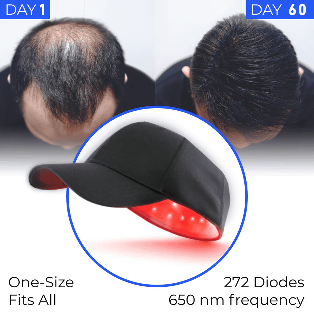 Regrow your hair in 60 days with Newyuo® Laser Cap — or your money back!