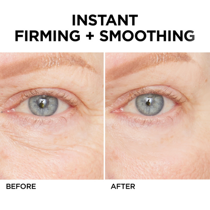 Lovilds™ Instant Wrinkle Eye Tightener cream(Buy 1, Get 1 Free – Last Day!)