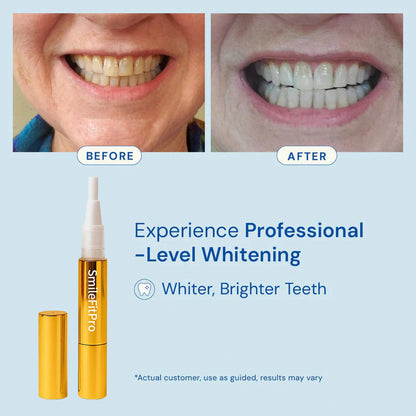 SmileFitPro® – Whiten & Restore in One Swipe