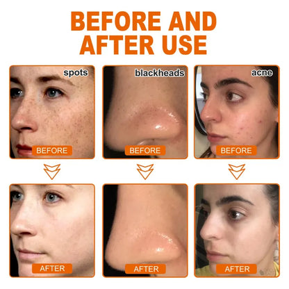 ✅Official Store | BBOJI™ WHITEN AND LIGHTEN SPOTS MASK(Buy 1 Get 1 Free)