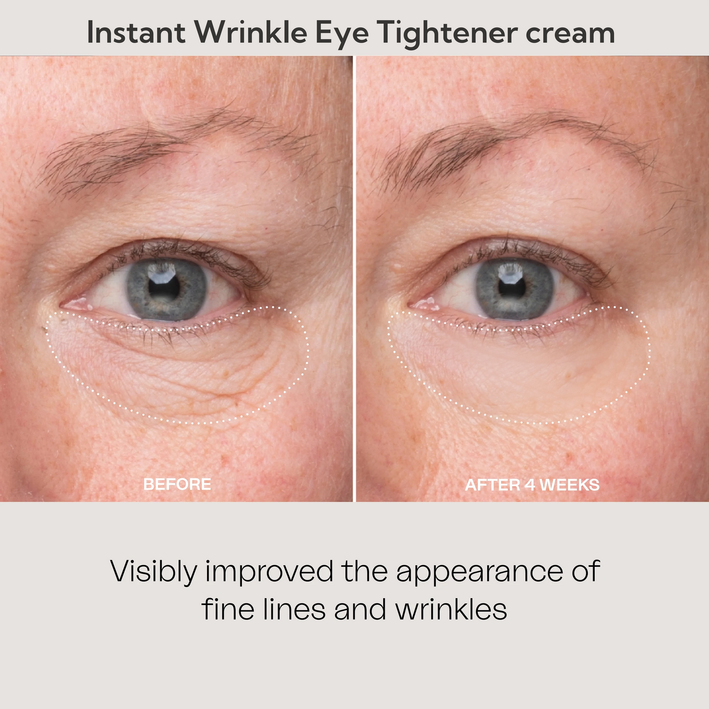 Lovilds™ Instant Wrinkle Eye Tightener cream(Buy 1, Get 1 Free – Last Day!)