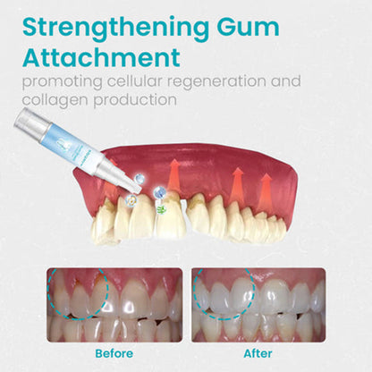 ✅Official Store | NESLEMY™ Gum Shield Therapy Gel✅FDA Approved
