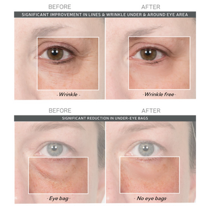 Lovilds™ Instant Wrinkle Eye Tightener cream(Buy 1, Get 1 Free – Last Day!)