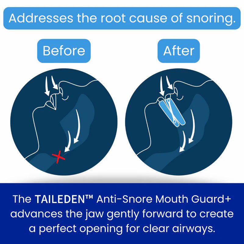 TAILEDEN™ Anti-Snore Mouth Guard+
