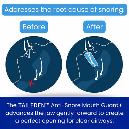 TAILEDEN™ Anti-Snore Mouth Guard+