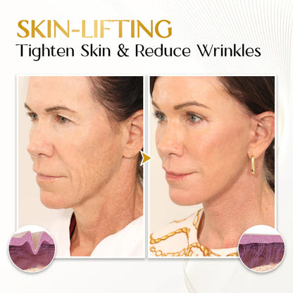 BBOJI™ Retinal Anti-Aging & Whitening Serum - With Adenosine, Niacinamide, and Retinal - Smooths Wrinkles, Improves Skin Tone & Elasticity - 150ml
