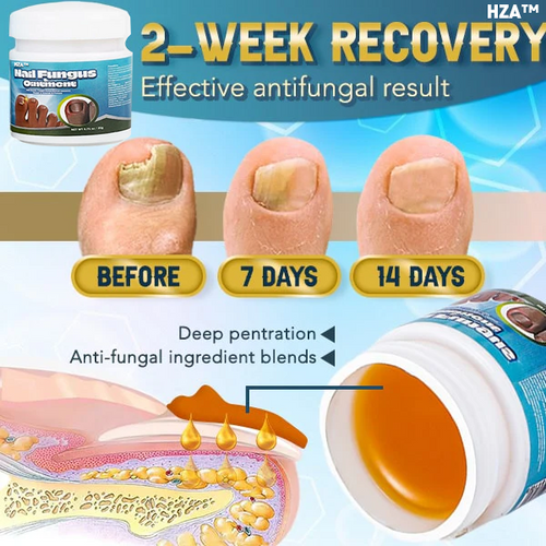 HZA™ 5X Quick-healing Nail Fungus Ointment