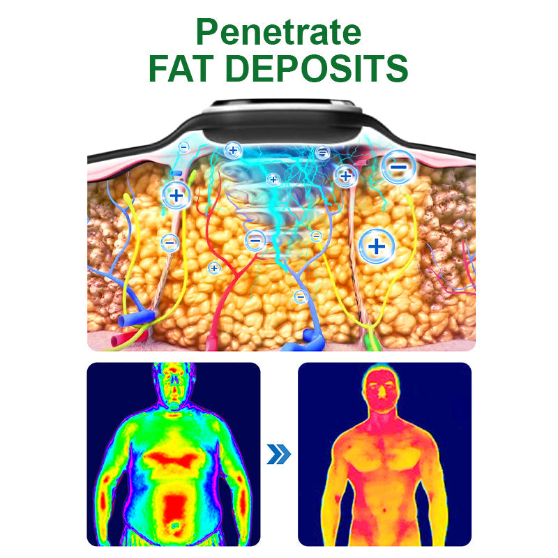 ✅FDA-approved | DIYSTAR™ Ultrasonic Fat Blasting and Detoxing Wristband