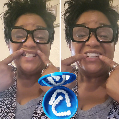 SmileFitPro™ — Custom-Fit, Affordable Denture Solution to Restore Your Natural Smile at Home