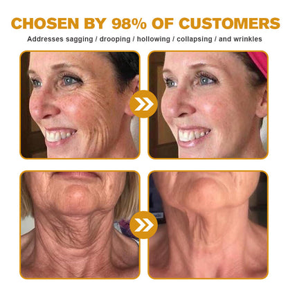 🐝🎁Made and Shipped from USA✨LOVILDS™ Bee Toxin Wrinkle Removal Cream-🔥LAST DAY 80% OFF