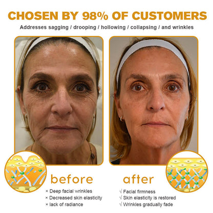 🐝🎁Made and Shipped from USA✨LOVILDS™ Bee Toxin Wrinkle Removal Cream-🔥LAST DAY 80% OFF